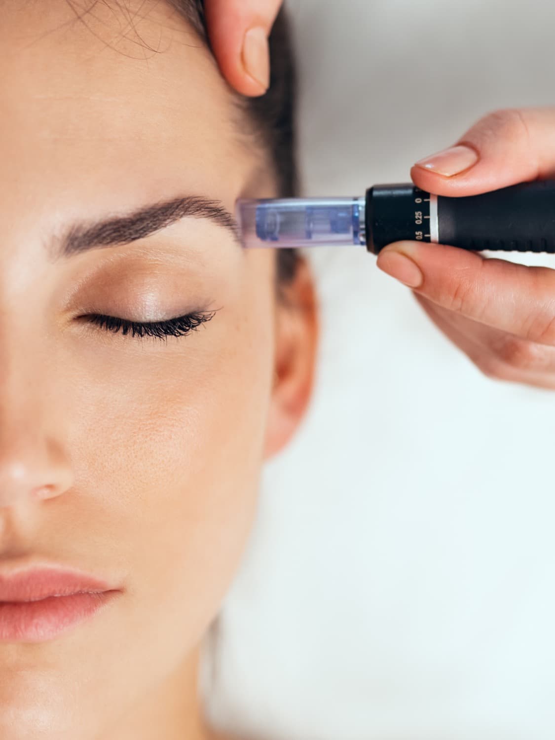 Dermapen & otolog fibroblast nedir?
