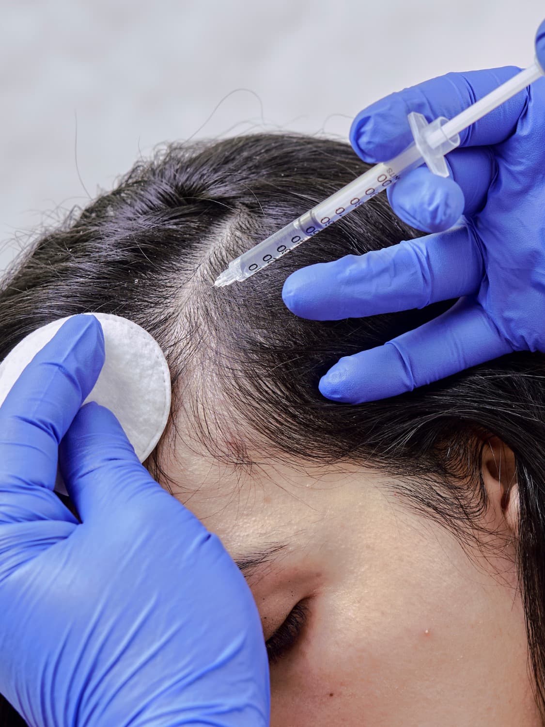 Saç Kökü Nasıl Beslenir? Serum ve Topikal Tedaviler Gerçekten İşe Yarar mı?