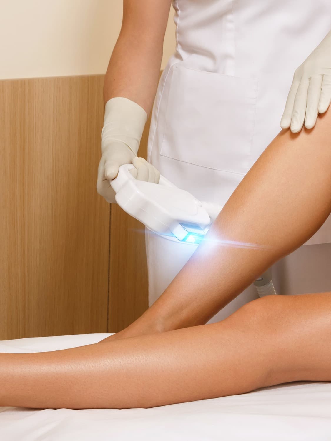Lazer epilasyon nedir?